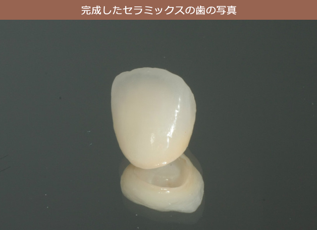 完成したセラミックスの歯の写真