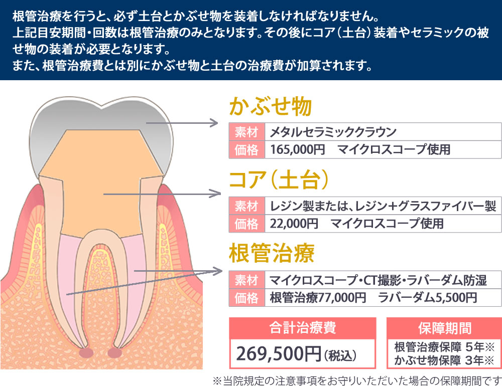 根管治療の治療費
