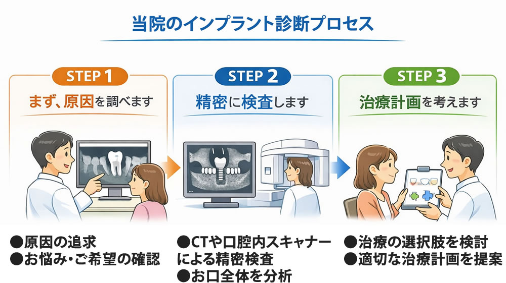 当院のインプラント診断プロセス